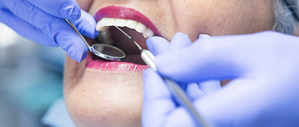 Best Broken or Chipped Tooth Repair in Beechwood Village, KY